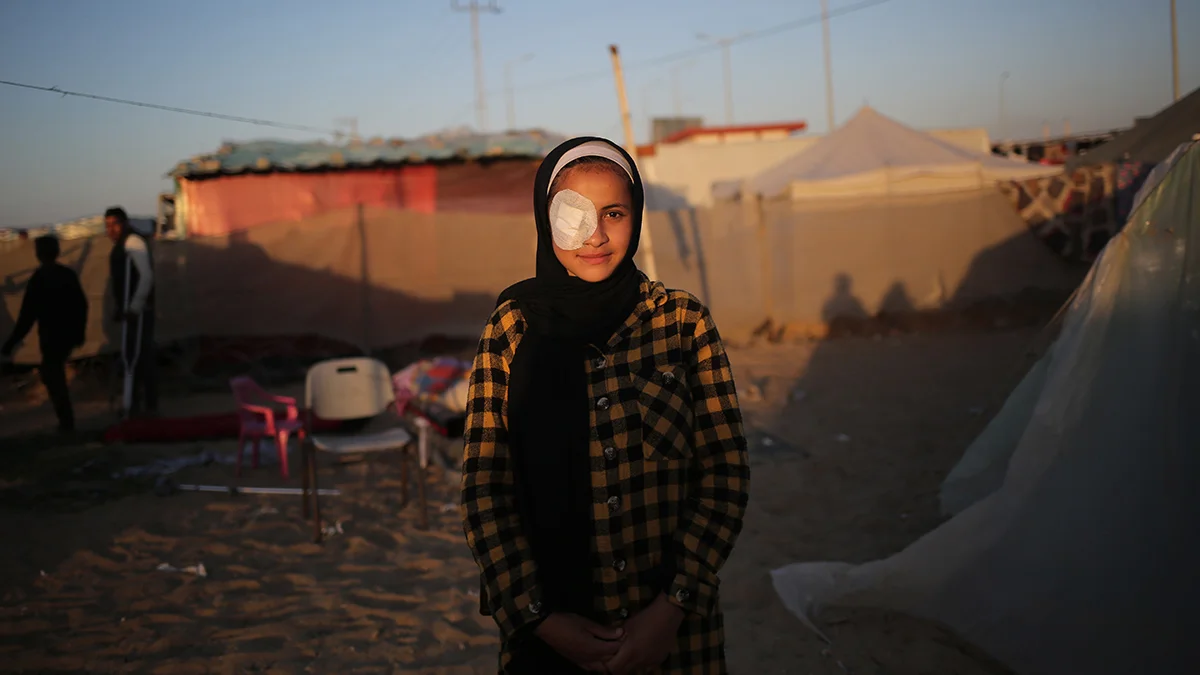 Die 15-jährige Abrar verlor bei dem Angriff auf ihr Haus im Gazastreifen ihr rechtes Auge.